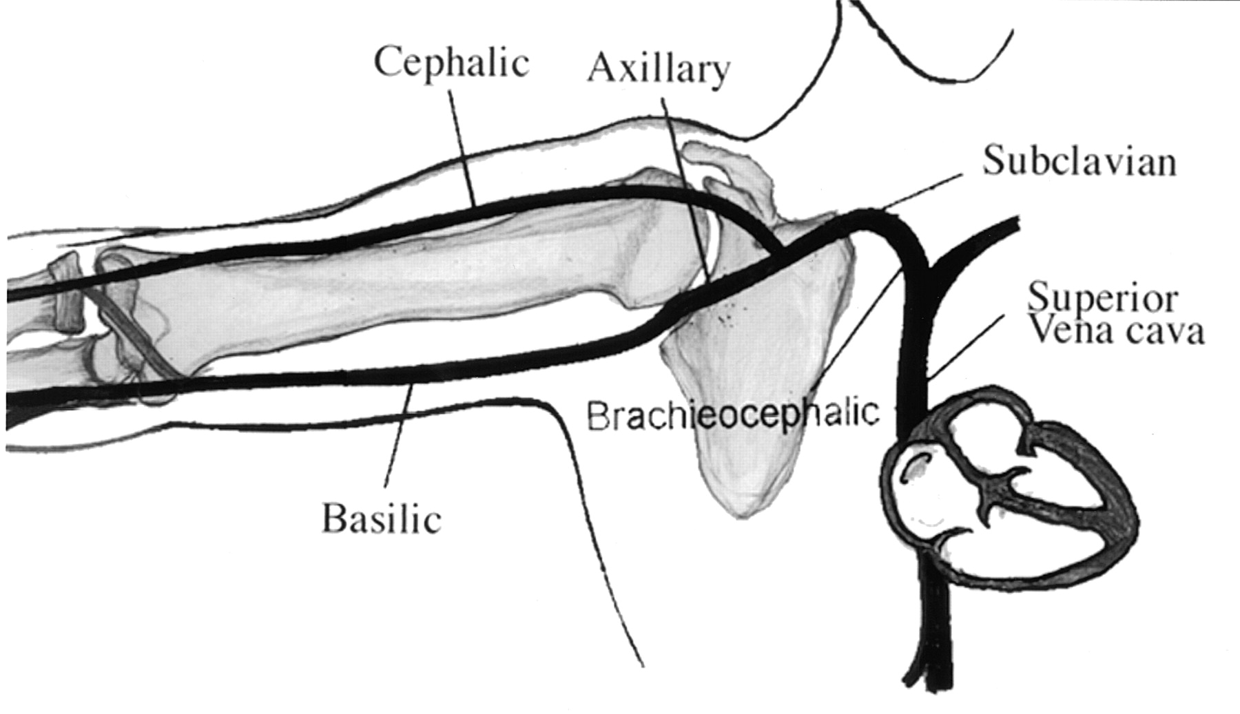 upper-extremity-veins-new-health-advisor